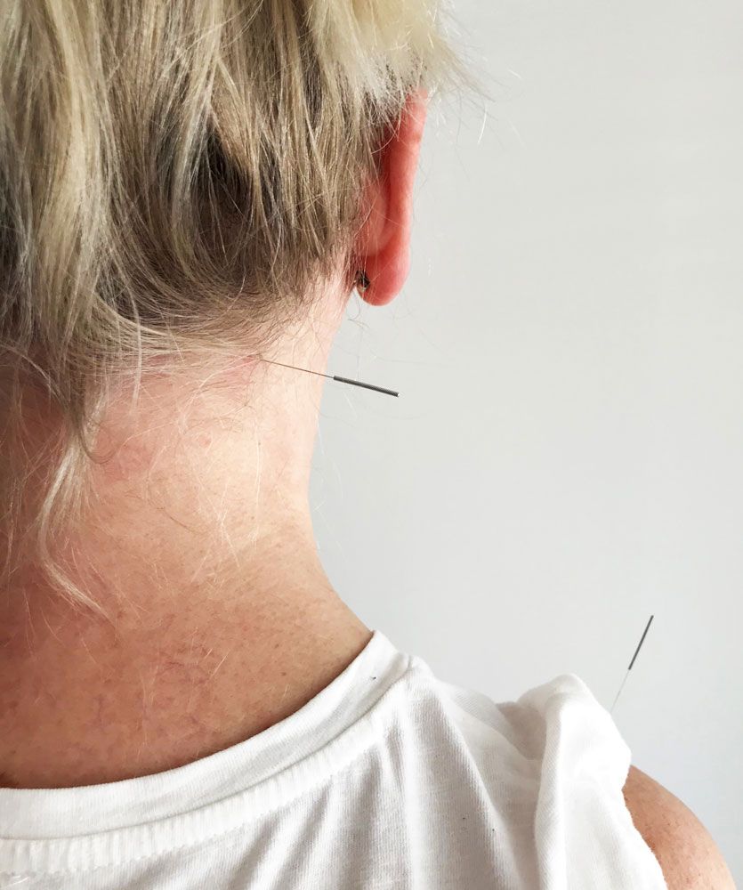 Akupunktur und Akupressur